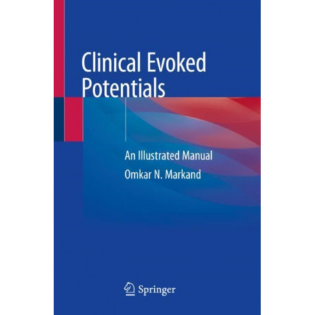 Clinical Evoked Potentials: An Illustrated Manual