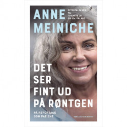 Det ser fint ud på røntgen: På reportage som patient