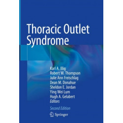 Thoracic Outlet Syndrome
