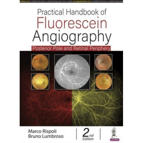 Practical Handbook of Fluorescein Angiography: Posterior Pole and Retinal Periphery