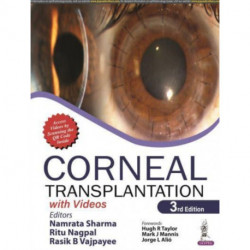 Corneal Transplantation: with Videos