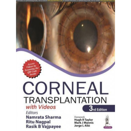 Corneal Transplantation: with Videos