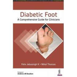 Diabetic Foot: A Comprehensive Guide for Clinicians