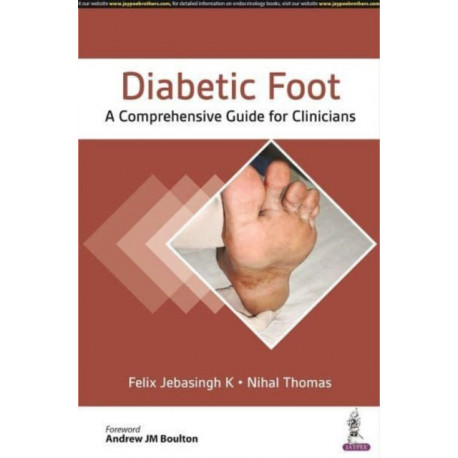 Diabetic Foot: A Comprehensive Guide for Clinicians