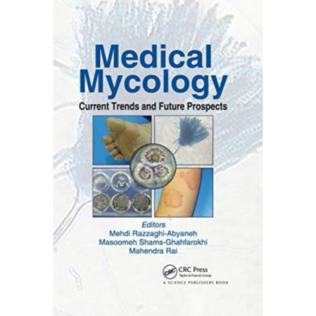 Medical Mycology: Current Trends and Future Prospects