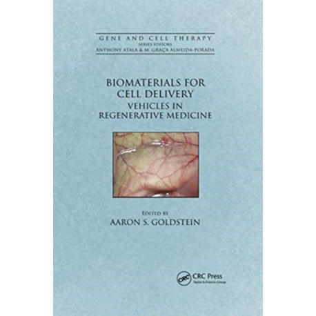 Biomaterials for Cell Delivery: Vehicles in Regenerative Medicine