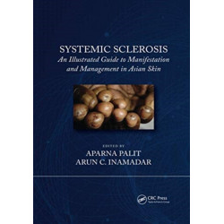 Systemic Sclerosis: An Illustrated Guide to Manifestation and Management in Asian Skin