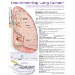 Understanding Lung Cancer Anatomical Chart