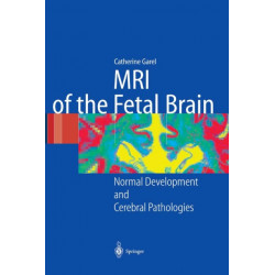 MRI of the Fetal Brain: Normal Development and Cerebral Pathologies