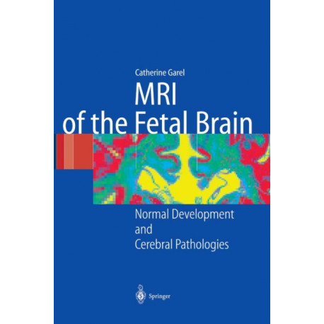 MRI of the Fetal Brain: Normal Development and Cerebral Pathologies