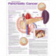 Understanding Pancreatic Cancer Anatomical Chart