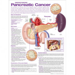 Understanding Pancreatic Cancer Anatomical Chart