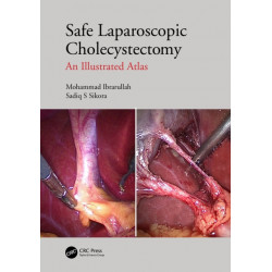 Safe Laparoscopic Cholecystectomy: An Illustrated Atlas