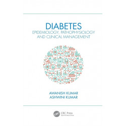 Diabetes: Epidemiology, Pathophysiology and Clinical Management