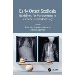 Early Onset Scoliosis: Guidelines for Management in Resource-Limited Settings