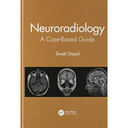 Neuroradiology: A Case-Based Guide