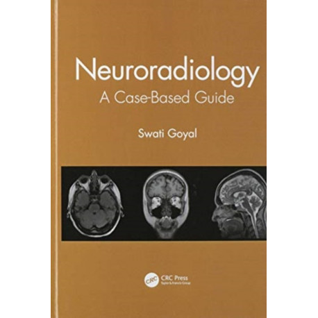 Neuroradiology: A Case-Based Guide