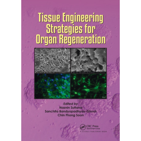 Tissue Engineering Strategies for Organ Regeneration