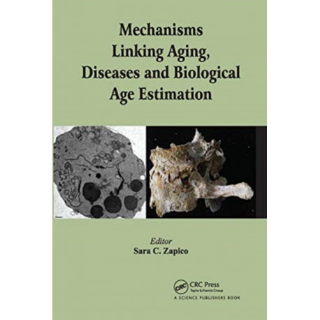 Mechanisms Linking Aging, Diseases and Biological Age Estimation