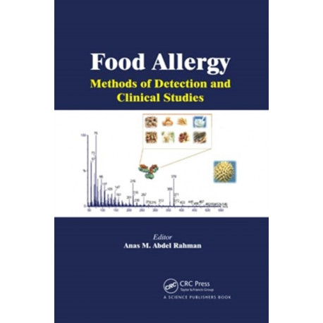 Food Allergy: Methods of Detection and Clinical Studies