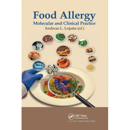 Food Allergy: Molecular and Clinical Practice