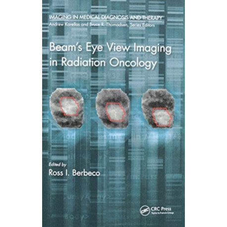 Beam's Eye View Imaging in Radiation Oncology
