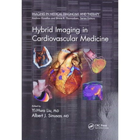 Hybrid Imaging in Cardiovascular Medicine