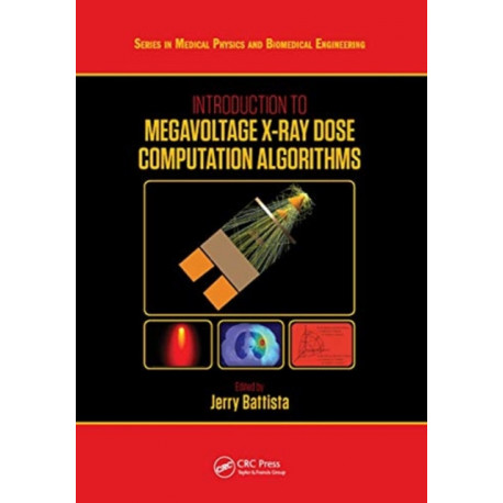 Introduction to Megavoltage X-Ray Dose Computation Algorithms