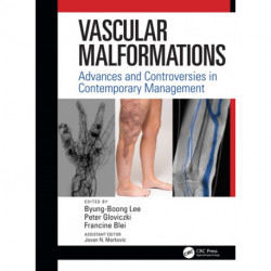 Vascular Malformations: Advances and Controversies in Contemporary Management