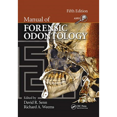 Manual of Forensic Odontology