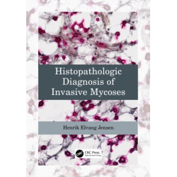 Histopathologic Diagnosis of Invasive Mycoses