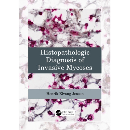 Histopathologic Diagnosis of Invasive Mycoses