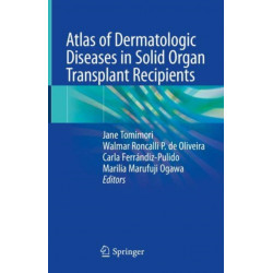 Atlas of Dermatologic Diseases in Solid Organ Transplant Recipients