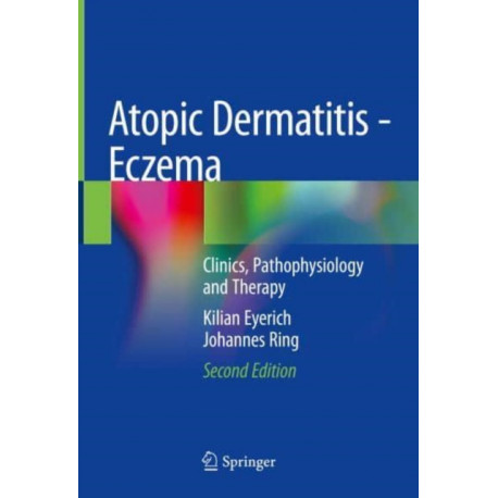 Atopic Dermatitis - Eczema: Clinics, Pathophysiology and Therapy