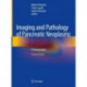 Imaging and Pathology of Pancreatic Neoplasms: A Pictorial Atlas