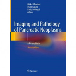 Imaging and Pathology of Pancreatic Neoplasms: A Pictorial Atlas
