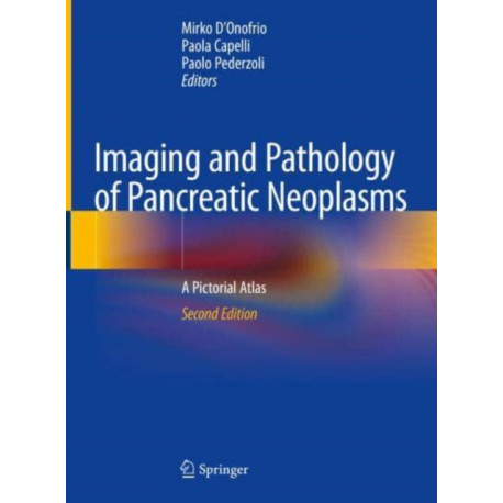 Imaging and Pathology of Pancreatic Neoplasms: A Pictorial Atlas