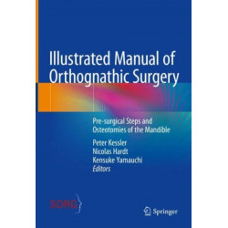 Illustrated Manual of Orthognathic Surgery: Osteotomies of the Mandible
