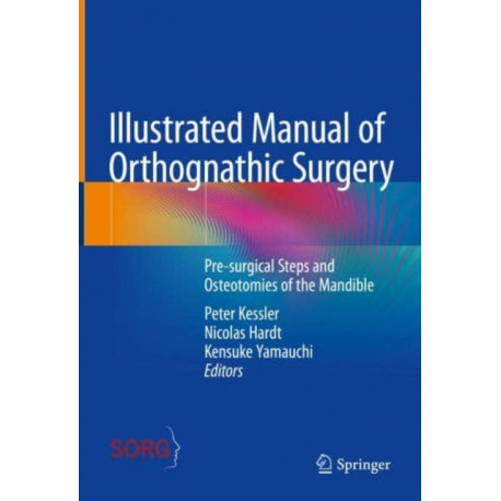 Illustrated Manual of Orthognathic Surgery: Osteotomies of the Mandible