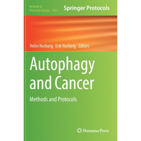 Autophagy and Cancer: Methods and Protocols
