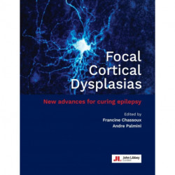 Focal Cortical Dysplasias: New advances for curing epilepsy