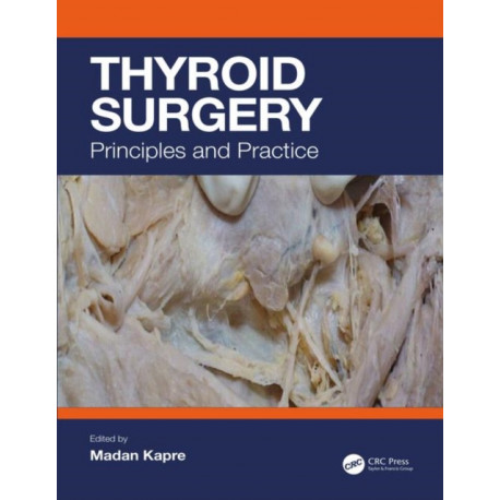 Thyroid Surgery: Principles and Practice