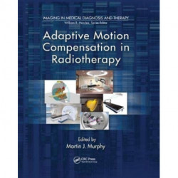 Adaptive Motion Compensation in Radiotherapy