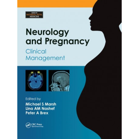 Neurology and Pregnancy: Clinical Management