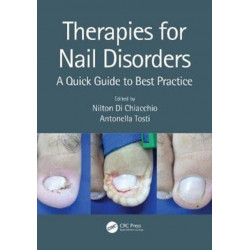 Therapies for Nail Disorders: A Quick Guide to Best Practice