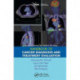 ESMO Handbook of Cancer Diagnosis and Treatment Evaluation