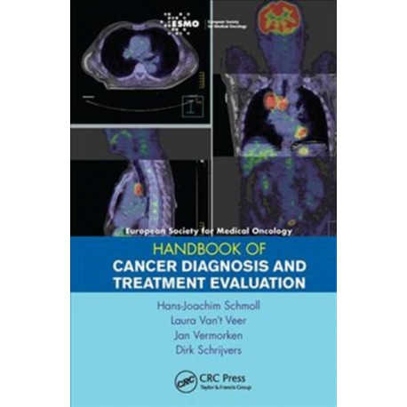 ESMO Handbook of Cancer Diagnosis and Treatment Evaluation