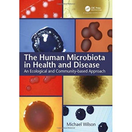 The Human Microbiota in Health and Disease: An Ecological and Community-based Approach
