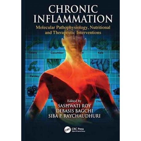 Chronic Inflammation: Molecular Pathophysiology, Nutritional and Therapeutic Interventions