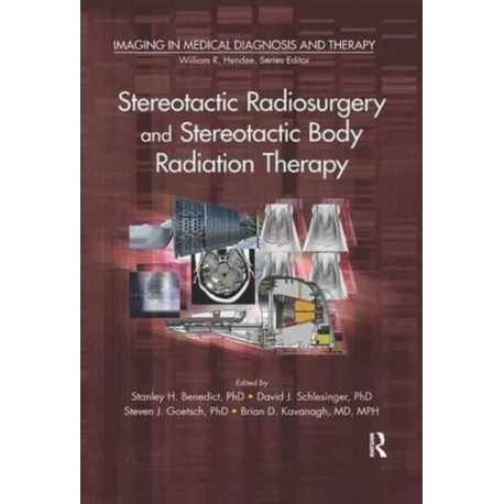 Stereotactic Radiosurgery and Stereotactic Body Radiation Therapy